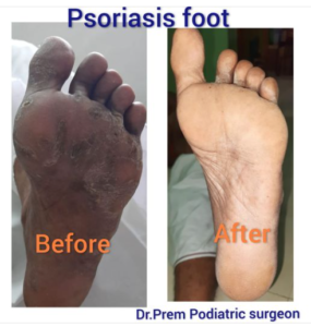 Your Trusted Foot Specialist Doctor in Chennai: Where Comfort and Care Converge