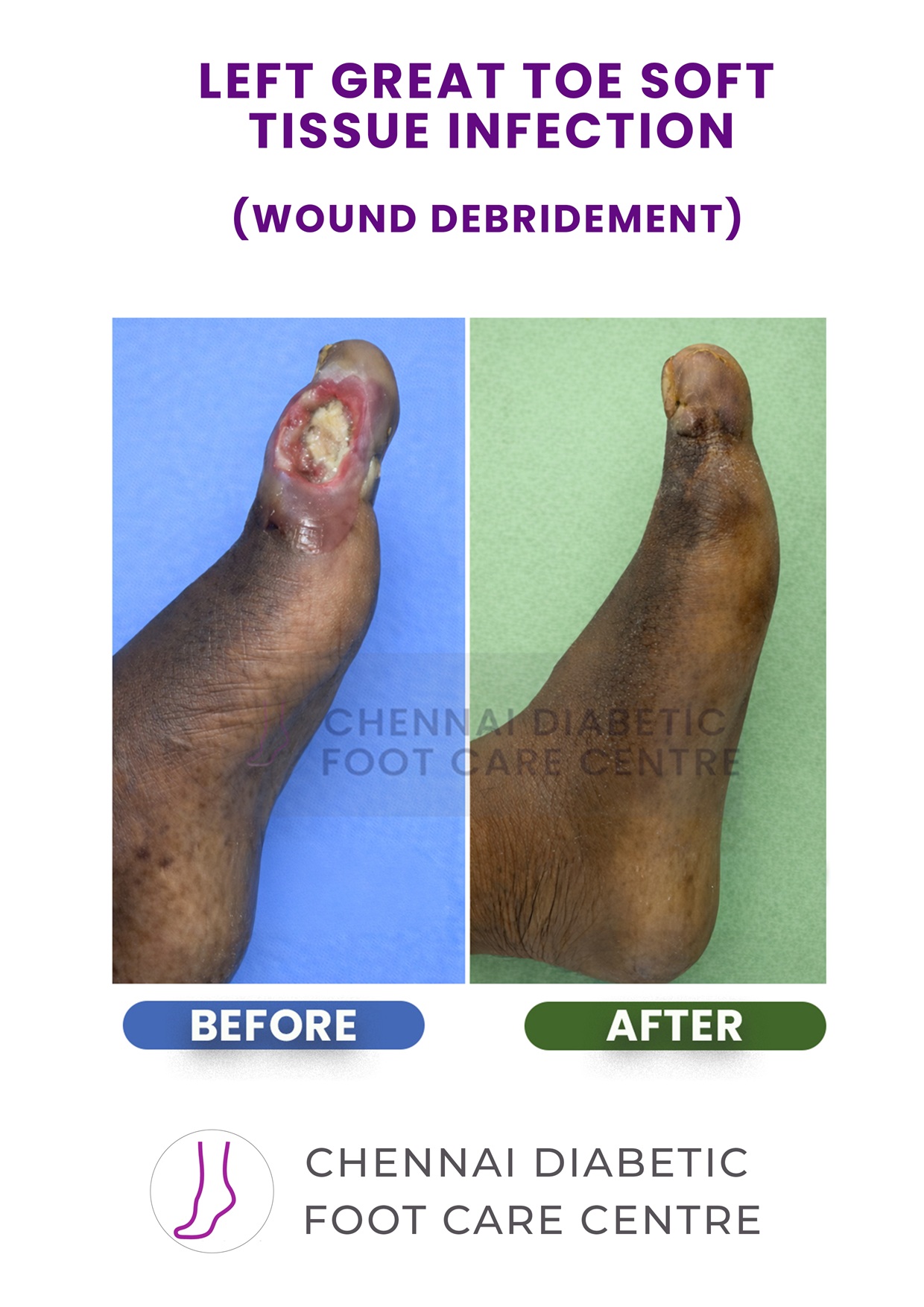 Before and After section image