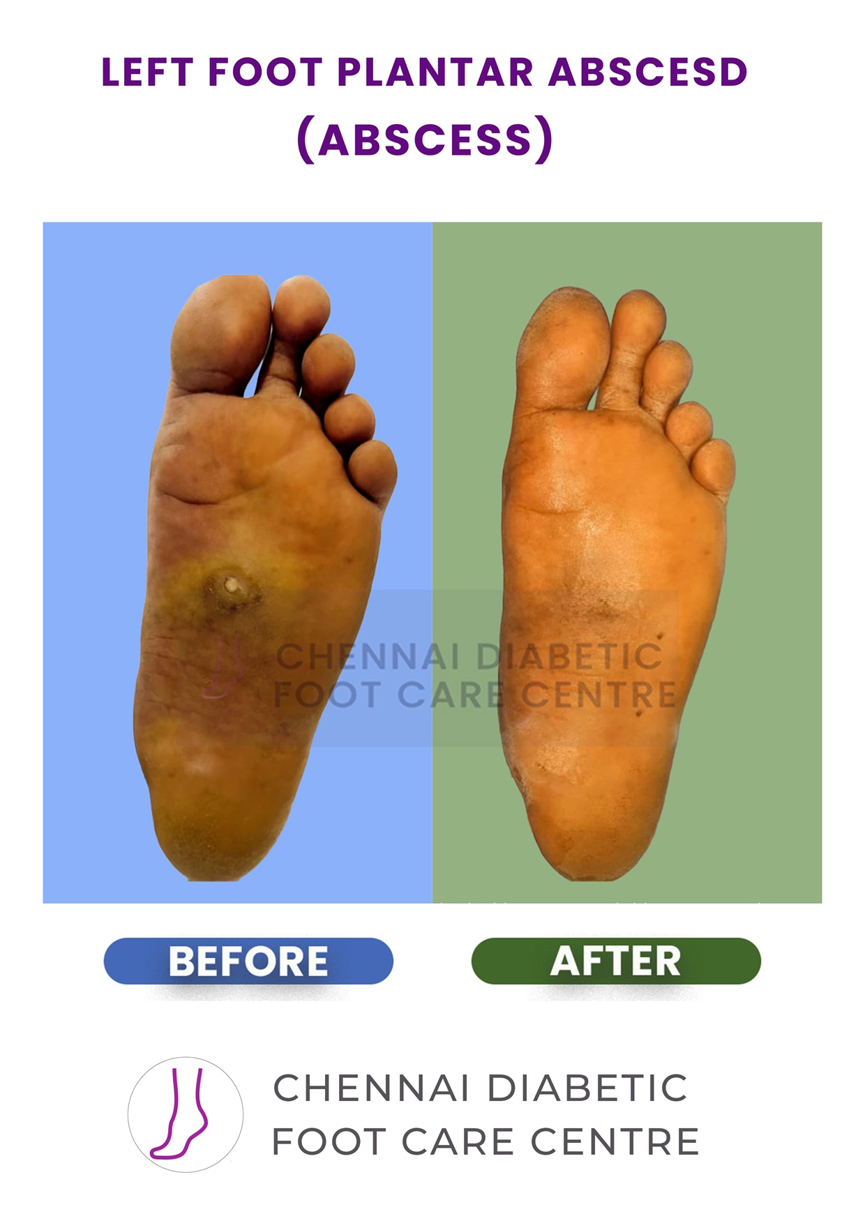 Before and After section image