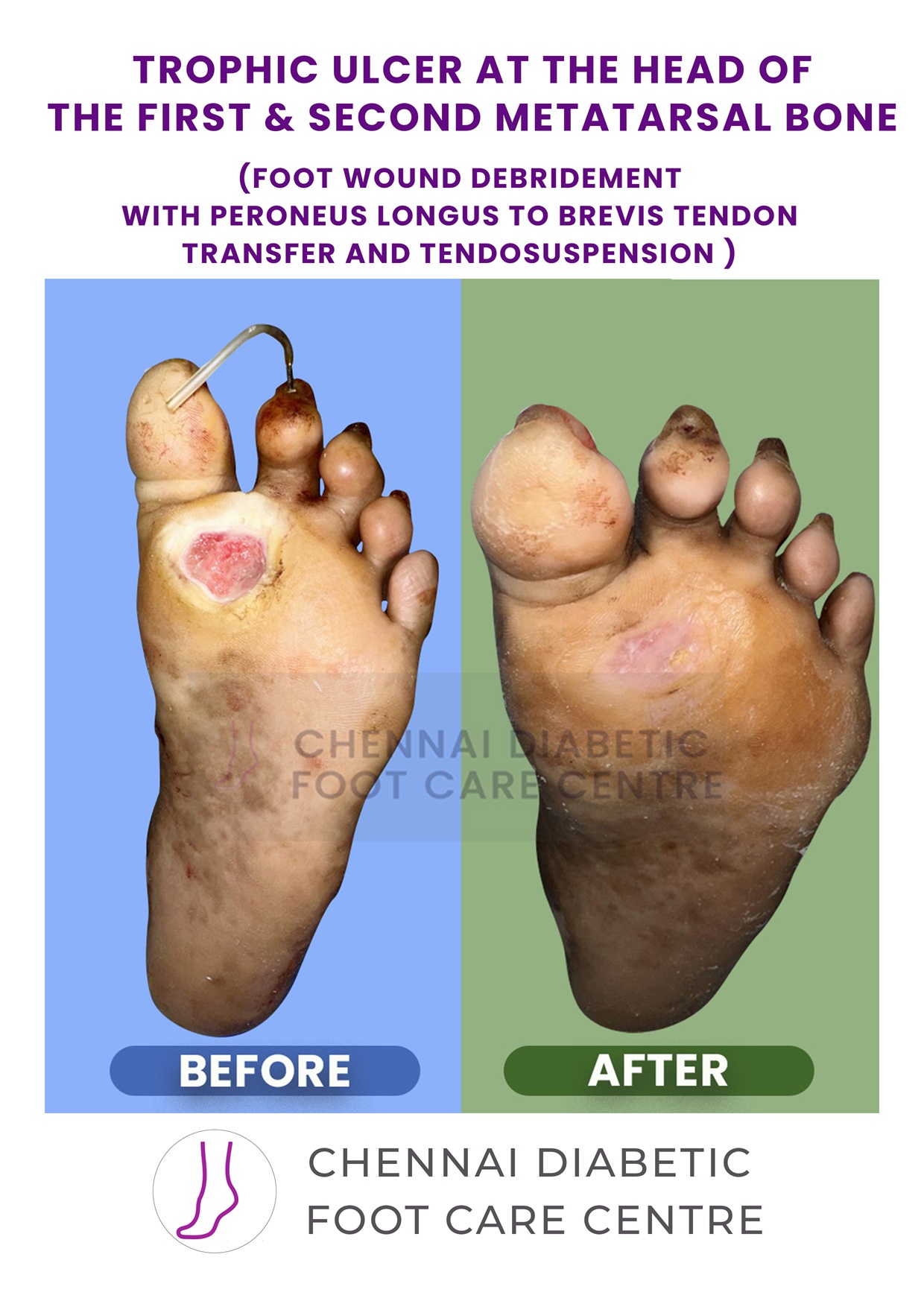 Before and After section image