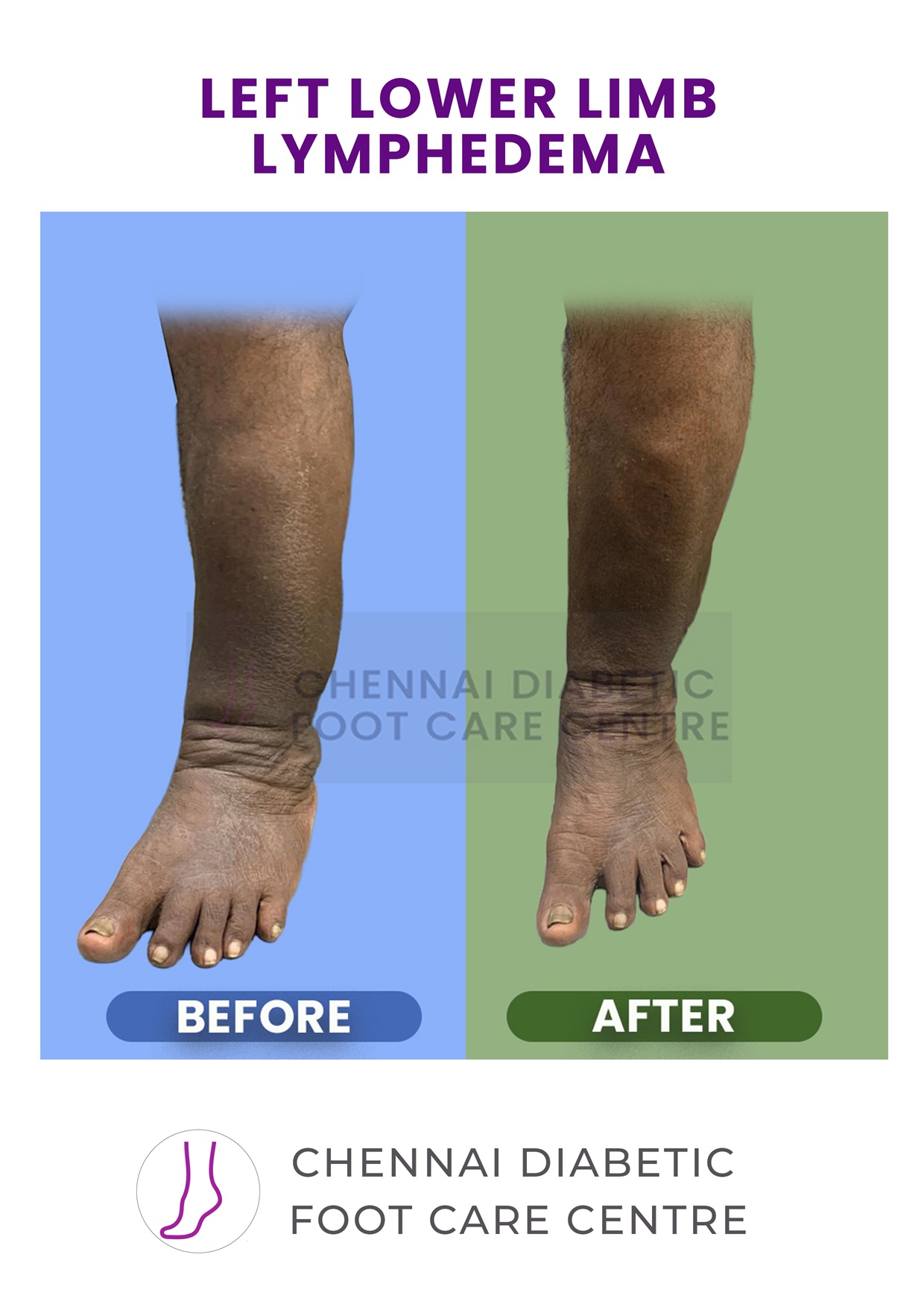 Before and After section image