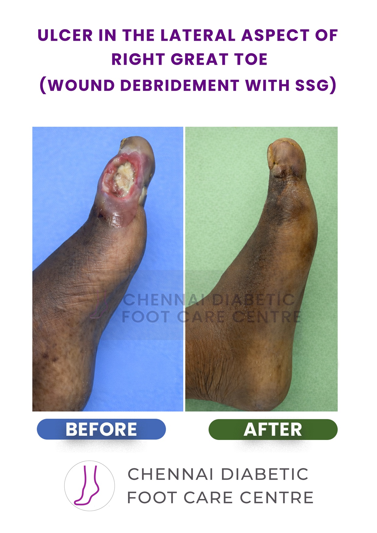 Before and After section image