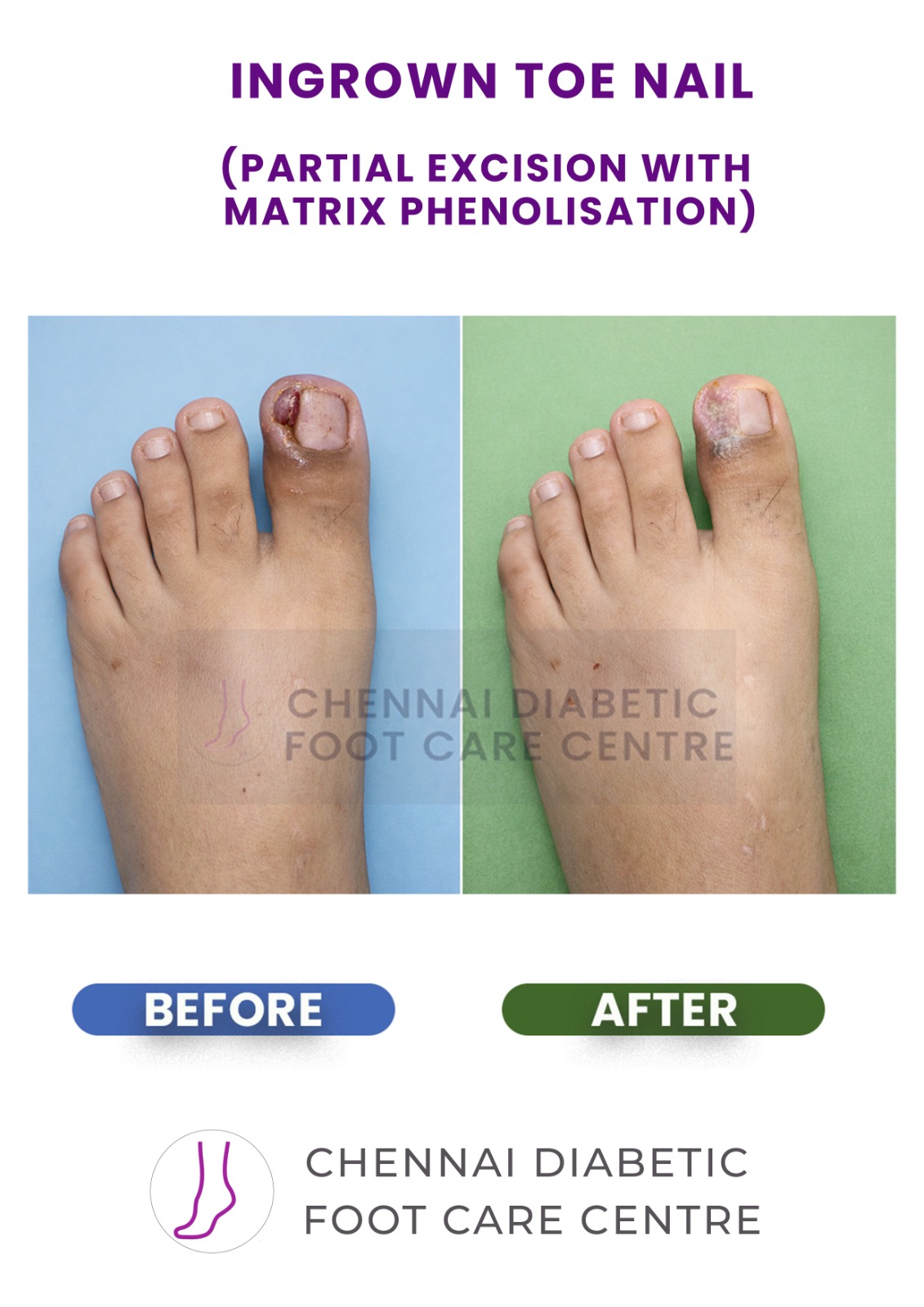 Before and After section image